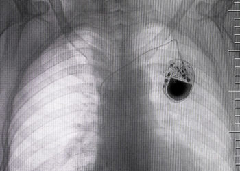 Fixing, upgrading and patching IoT devices can be a real nightmare